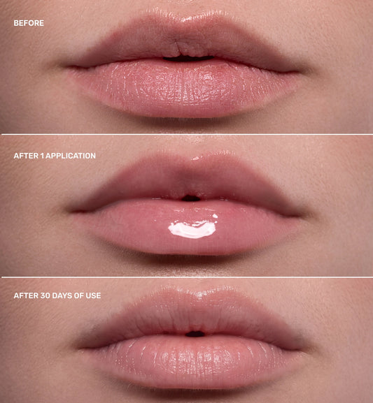 LIPSS COMFORT&PROTECT BALM